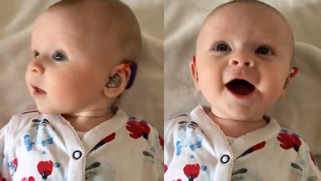 A baby with a hearing aid smiling