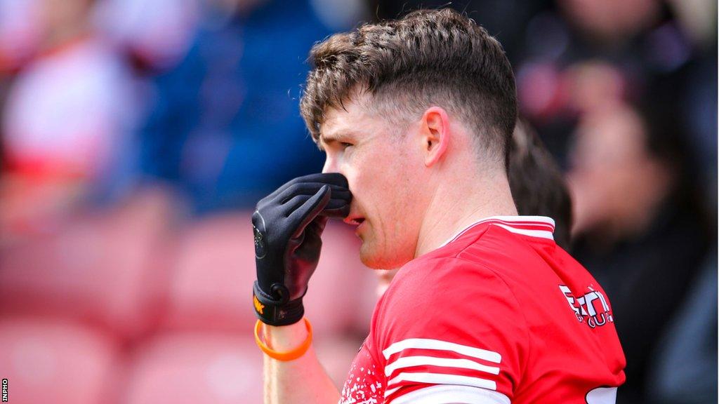 Gareth McKinless was forced off with a broken nose