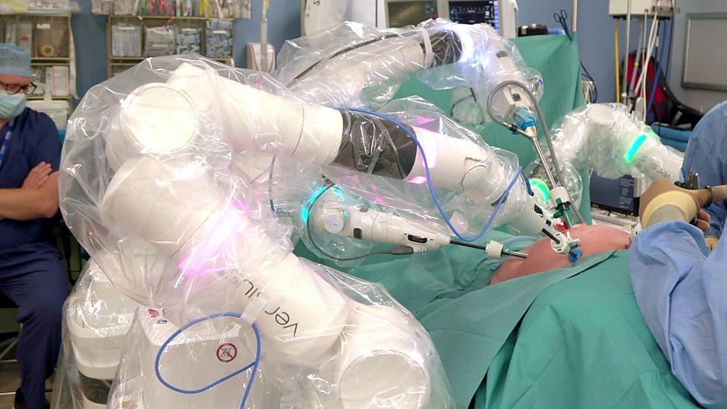 The Versius robotic arms performing surgery