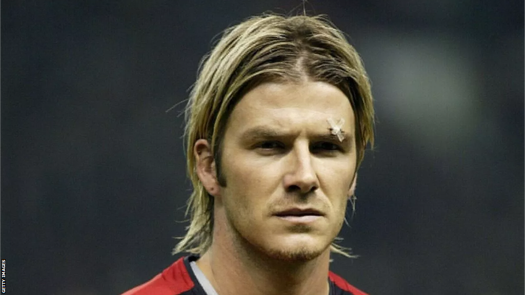 David Beckham with stitches above his eye