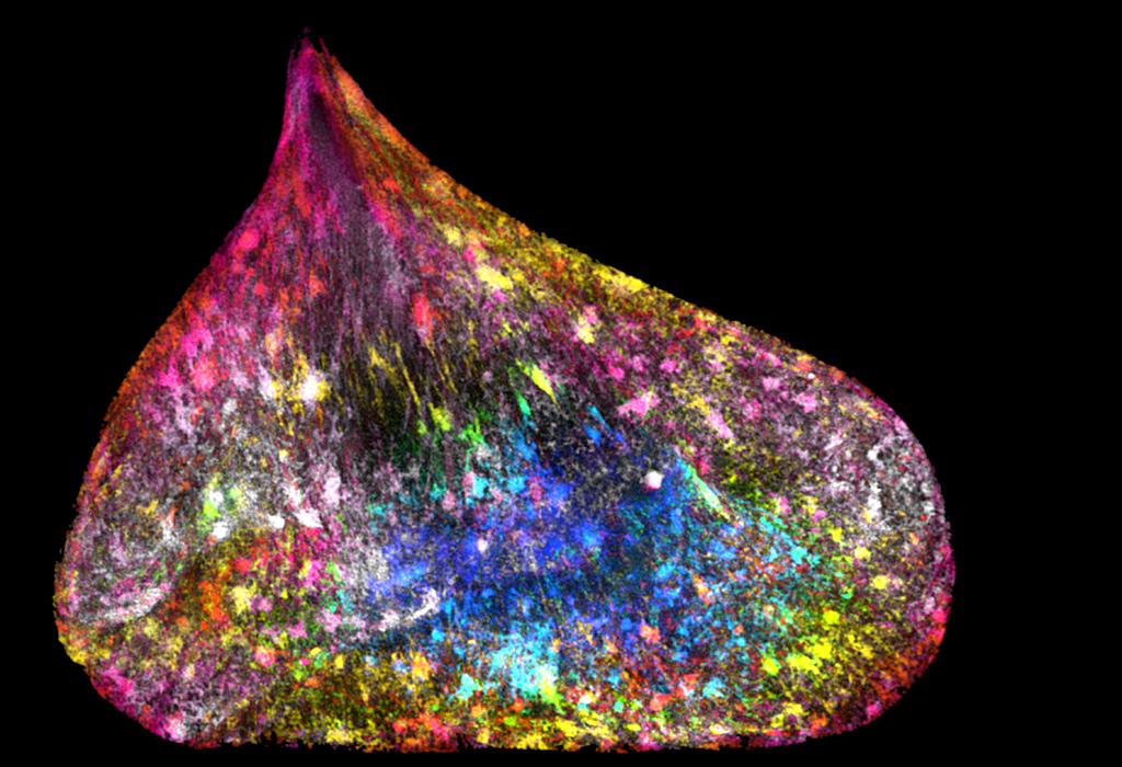 Unravelled DNA in a human lung cell