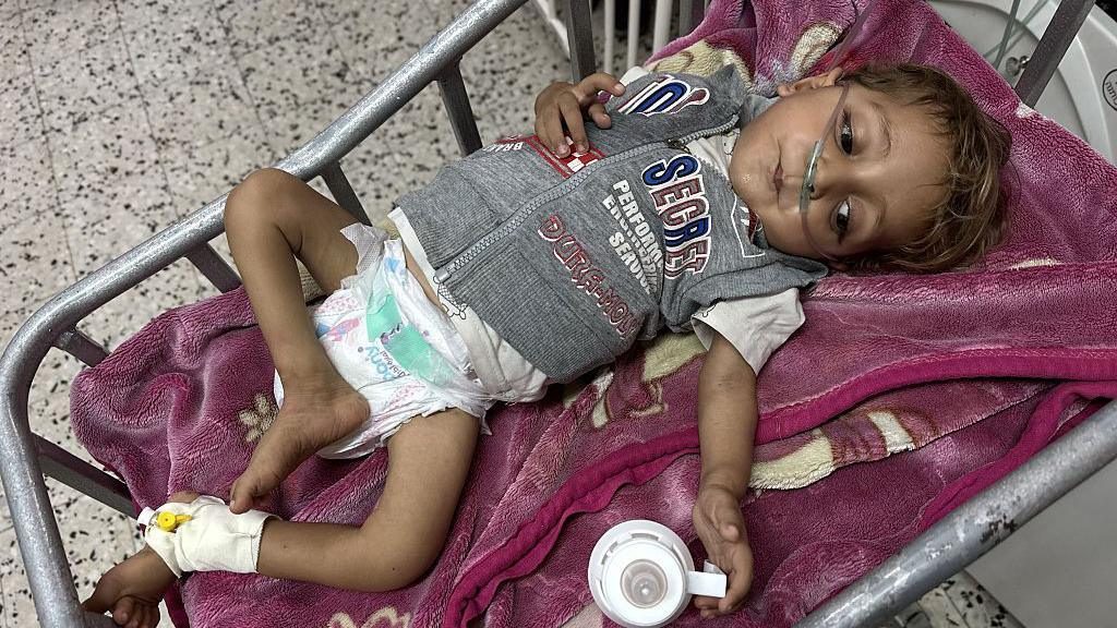A young child being treated at hospital in Gaza.