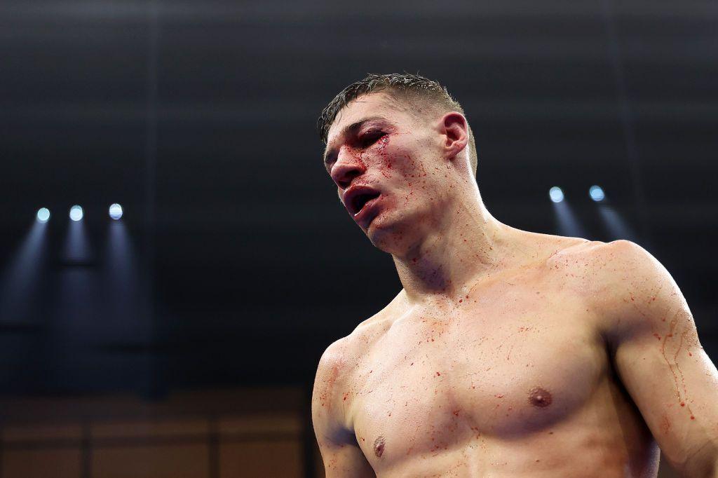  A bloodied Chris Billam-Smith in the ring