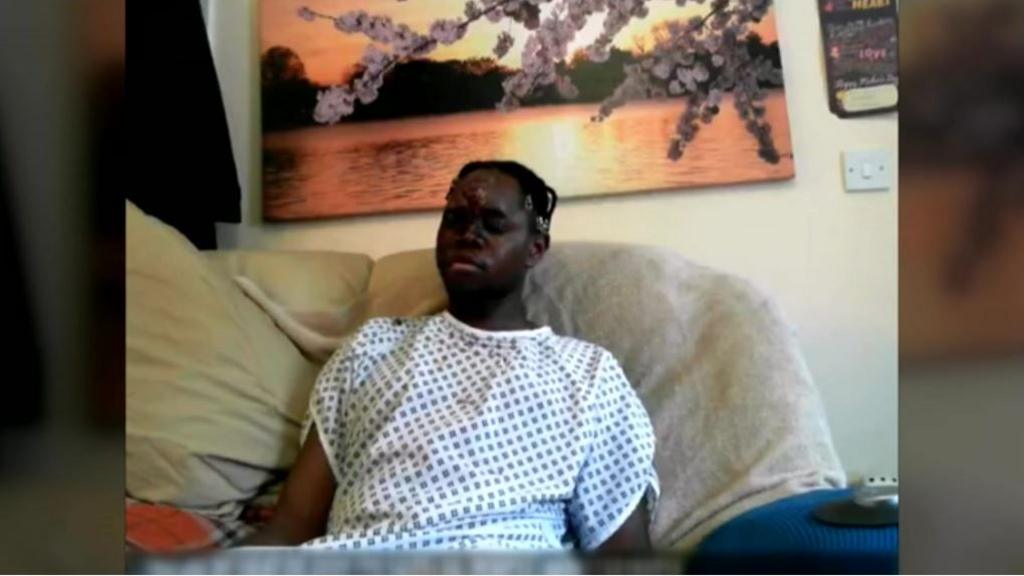 Katungua Tjitendero sat on a sofa wearing a hospital gown. There is a large painting of a lake on the wall behind him. 