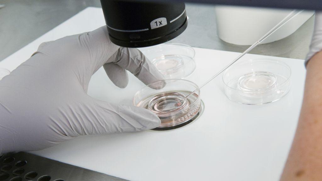 A doctor's gloved hand holds a petri dish containing sperm under a microscope