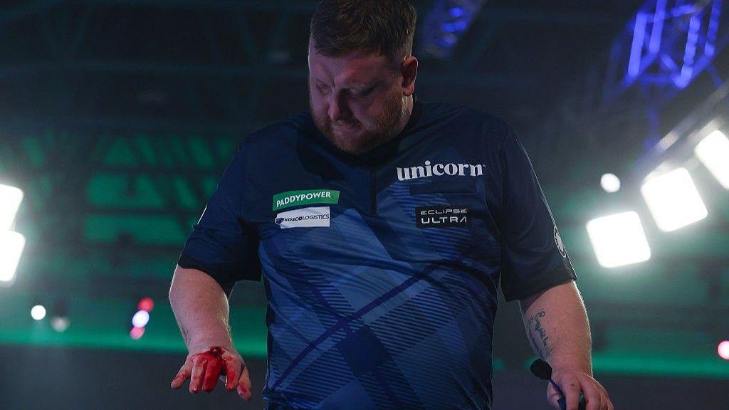 Cameron Menzies pictured with blood on his right hand as he leaves the stage following his loss at the World Championship