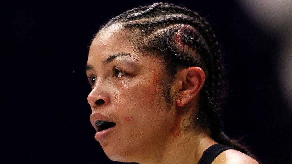 Jessica McCaskill's badly swollen left eye