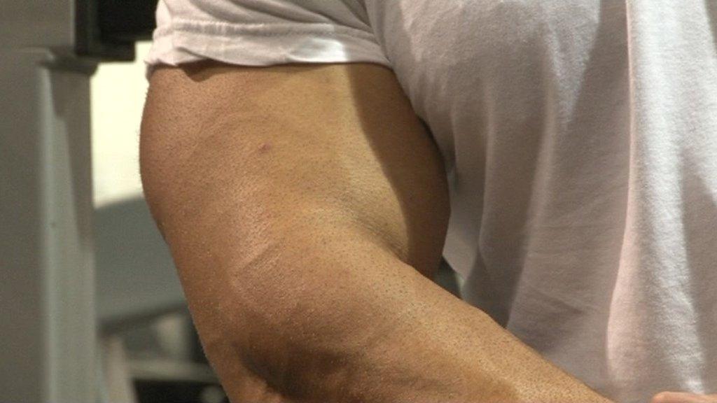 Anonymous steroid user's arm