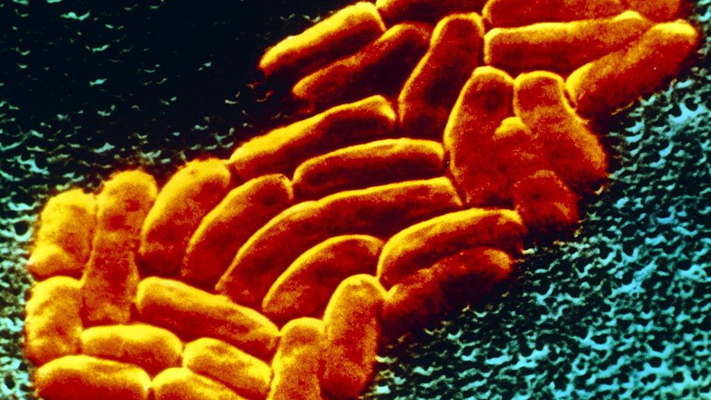 Klebsiella pneumonia bacteria