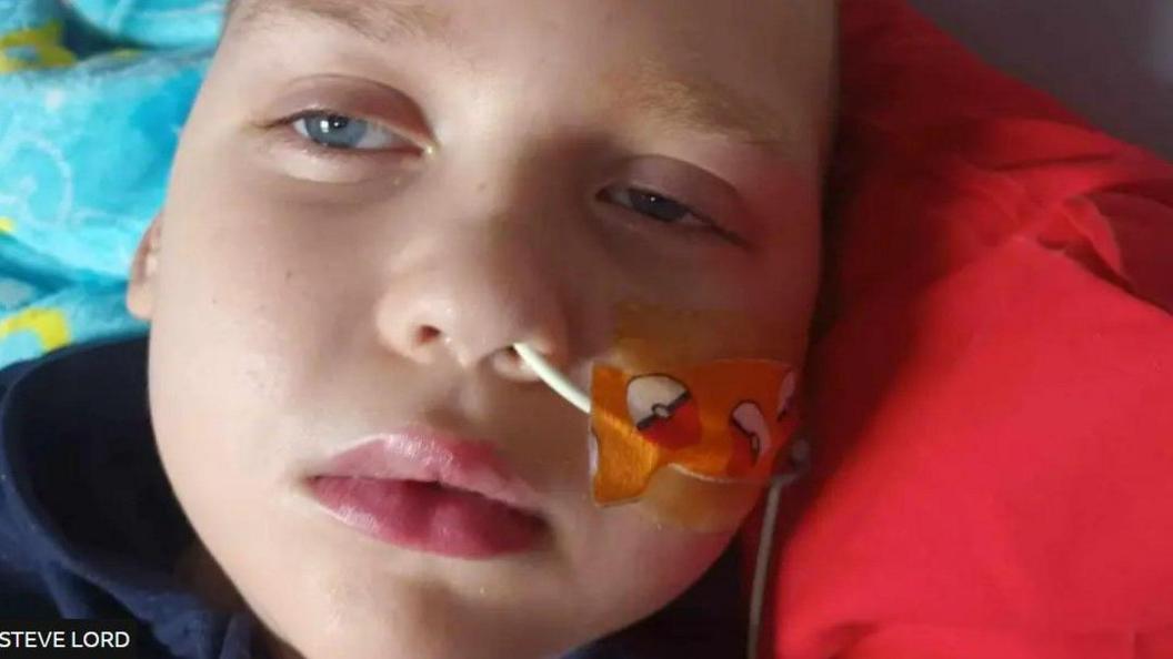 Ethan has blue eyes and is lying on a pillow with a naso-gastric tube taped to his cheek.