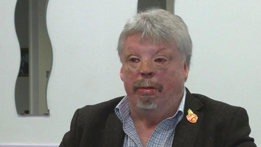 Simon Weston