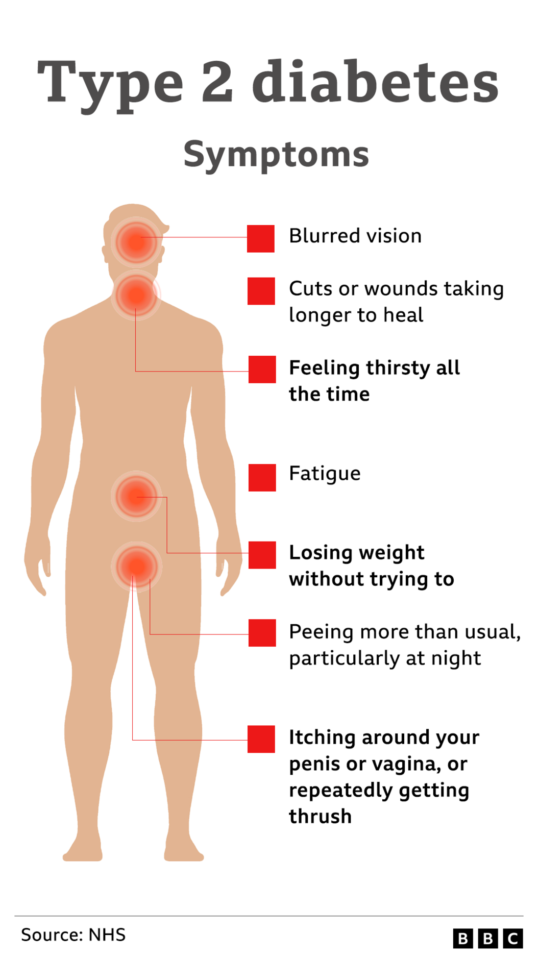 Type 2 diabetes symptoms