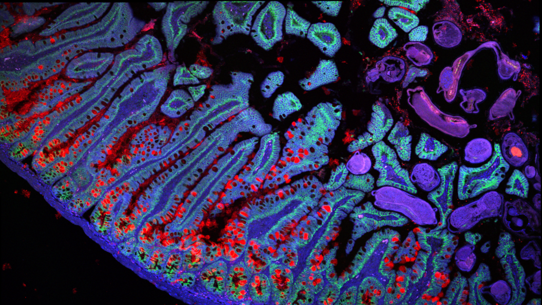 A kaleidoscopic image of the cells of the small intestine ranging from bright reds to deep purples. 