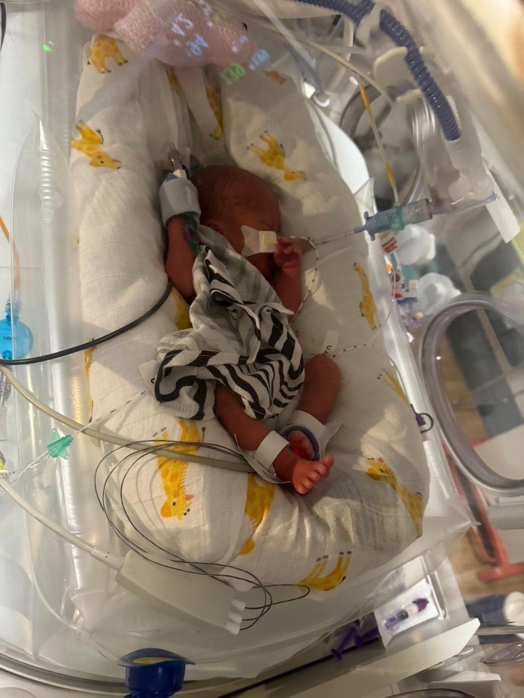 A newborn baby still in hospital, seen in her incubator.