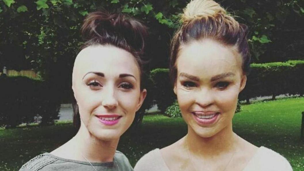 Adele Bellis posing next to Katie Piper. Adele has brown hair tied up in a bun, as does Katie but her hair is blonde. 