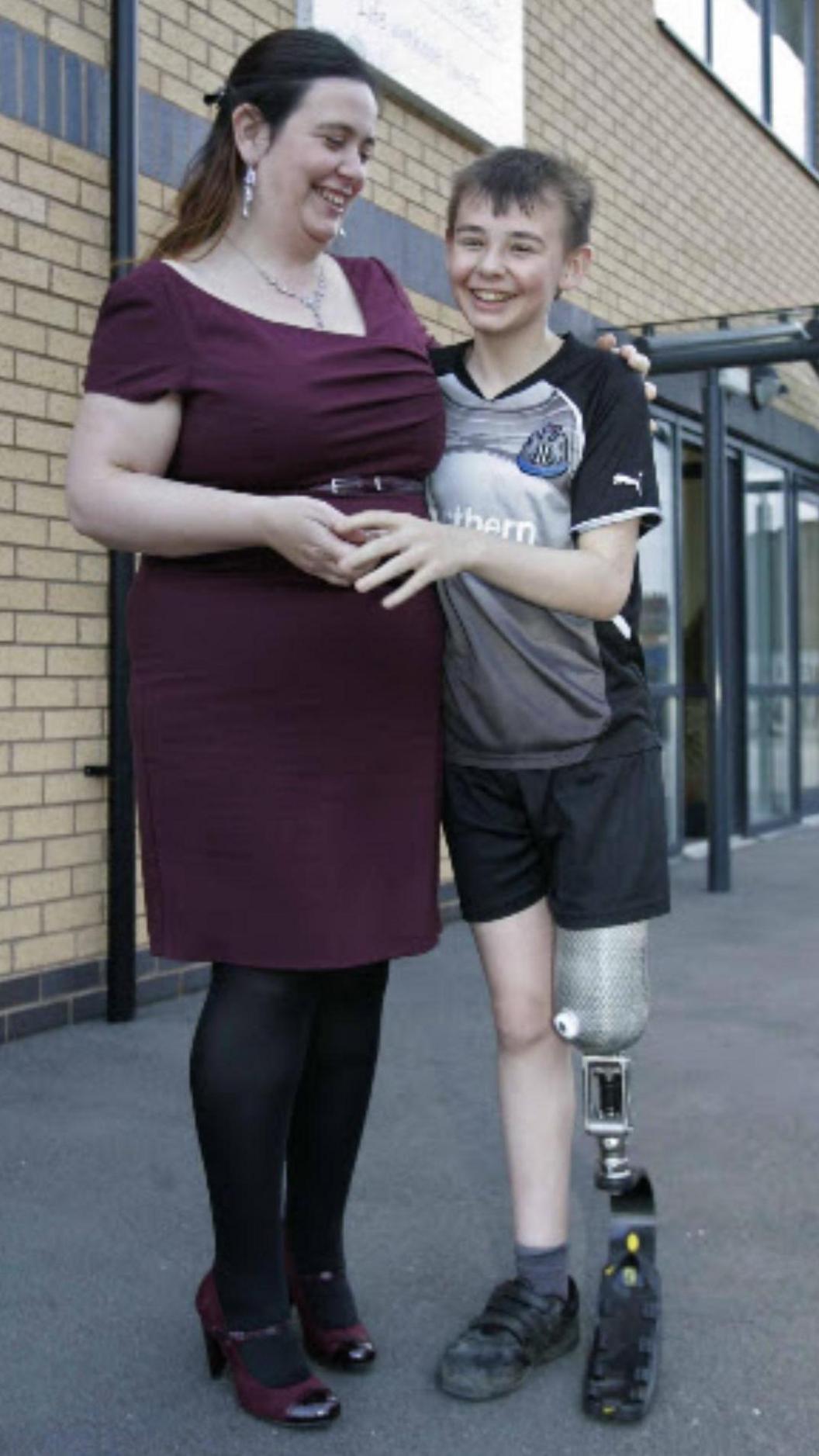 Nicola and Kieran Maxwell. Nicola has her arm around her smiling son. She has long dark hair and a maroon dress. He is wearing a Newcastle United shirt and black shorts. His left leg is a prosthetic.