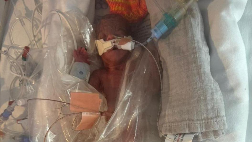 Baby wrapped in plastic sheet with tube attached