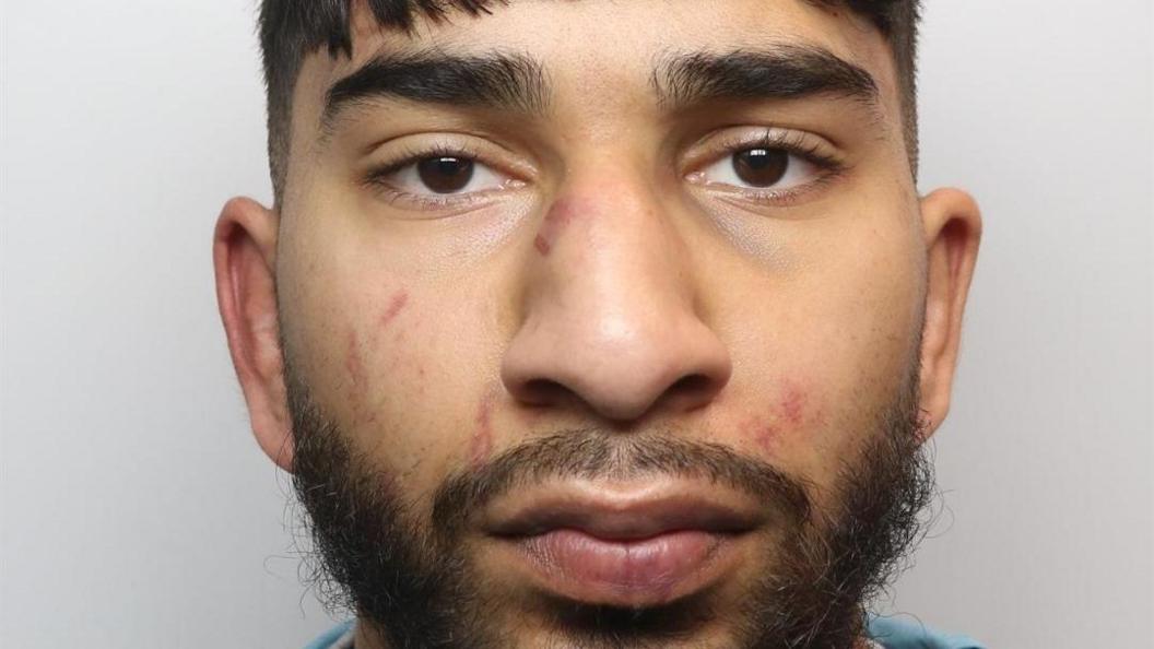 A mugshot of a young man with short dark hair and a dark beard. His face is covered in red scratches and bruising.
