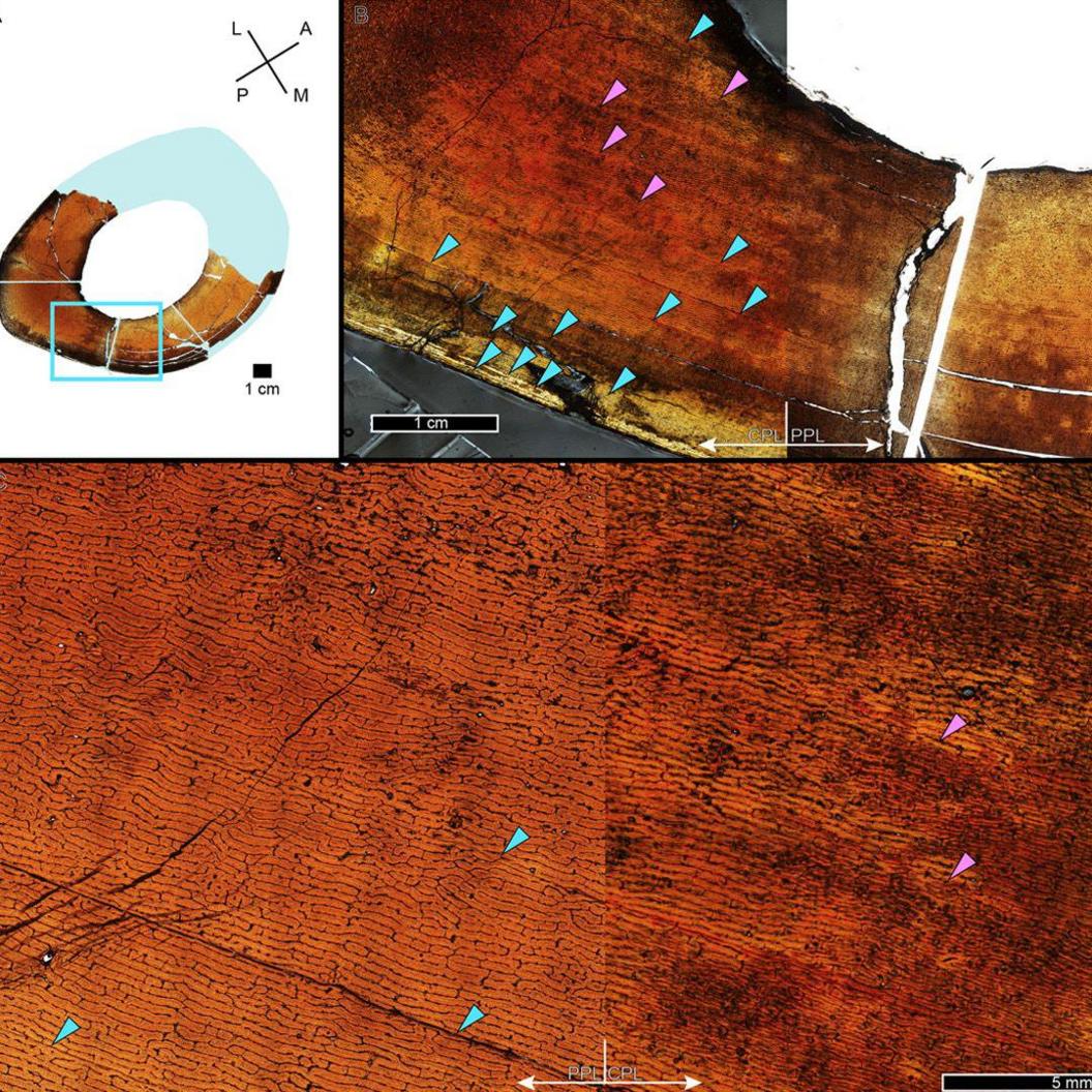 a close up of the bone rings