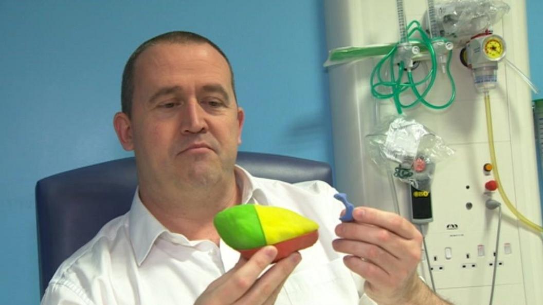 John Cousins with a model of his kidney