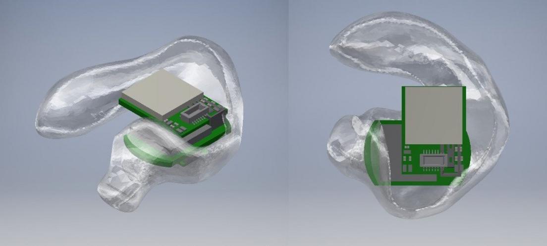 Brain activity monitor called an EEG which fits in the ear