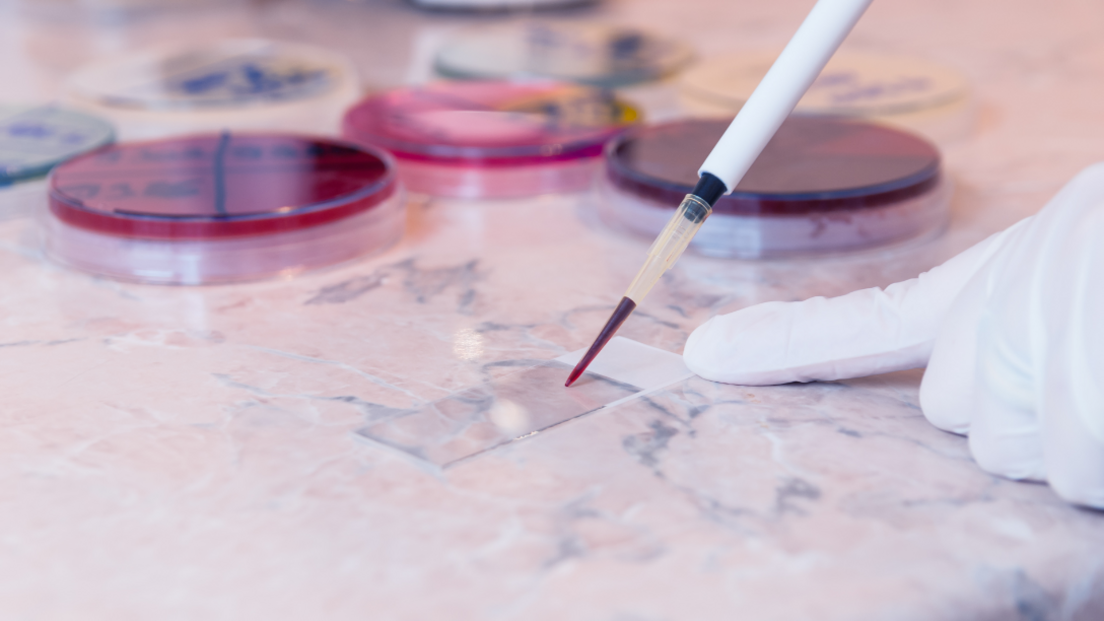 Three glass petri dishes filled with a red liquid. In front, a person wearing a white glove holds a small glass slide while using a white pipette to put some of the red liquid onto the slide.