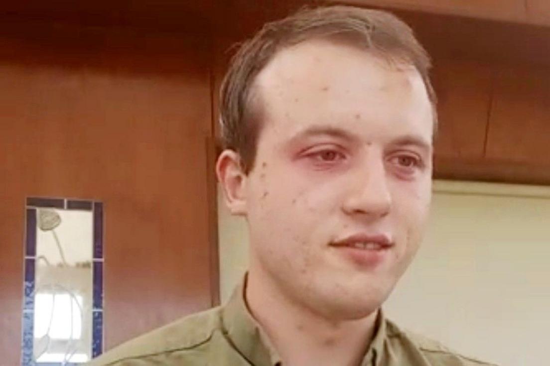 A man, with brown hair and pale skin. The skin around his eyes is red and he is wearing an olive coloured shirt.
