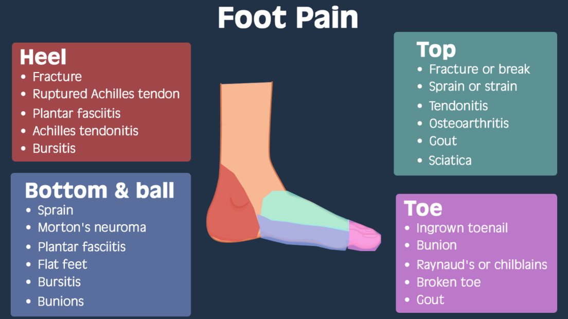 Foot pain infographic