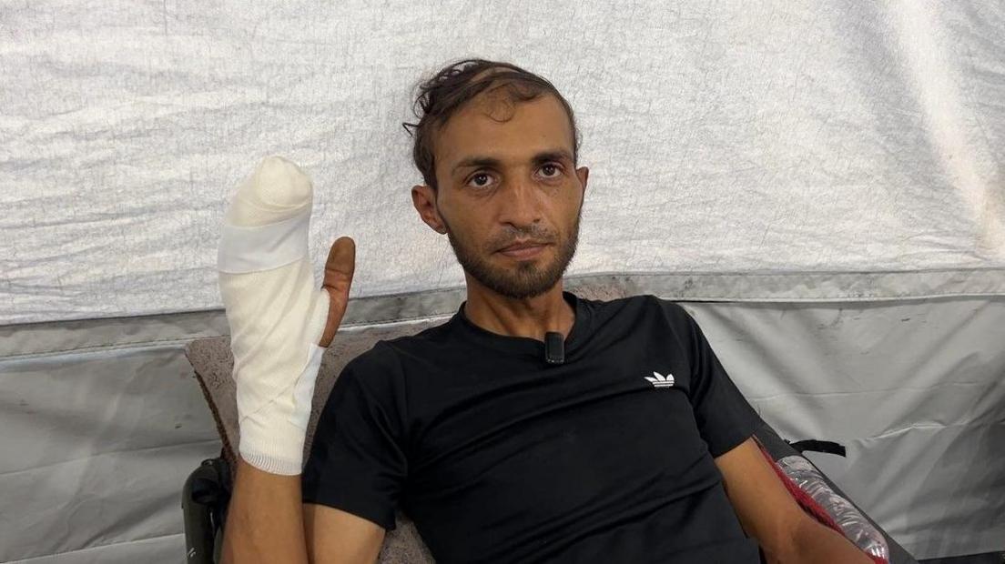 Mohammed al-Qedra holds up his injured hand while lying on a bed at the UK-Med field hospital in al-Mawasi, southern Gaza
