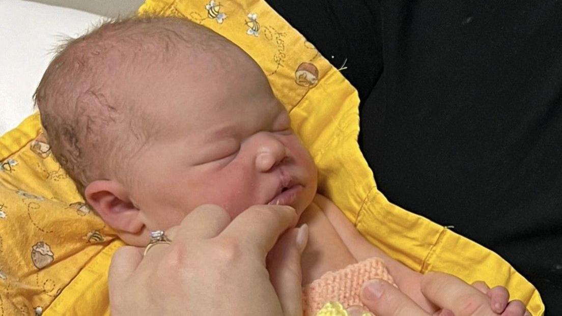Baby, Emmy Russo after being born by caesarian section at the Princess Alexandra Hospital in Harlow. She is newborn in the picture and has her eyes closed, she is laying on a yellow sheet and her mother is stroking her chin. She is wrapped in a wool, homemade blanket.