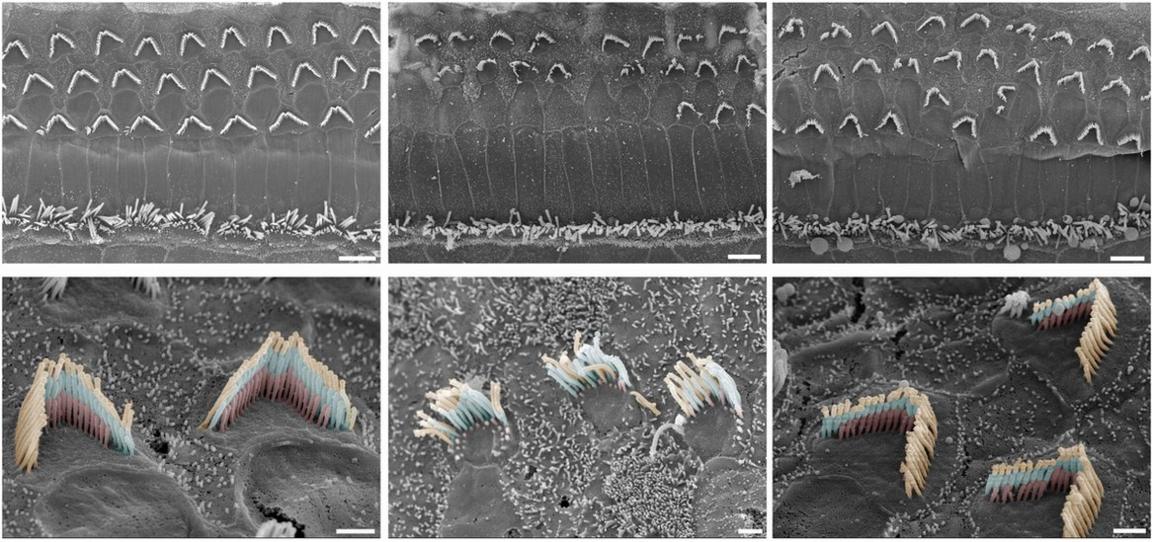 The hairs of the ear