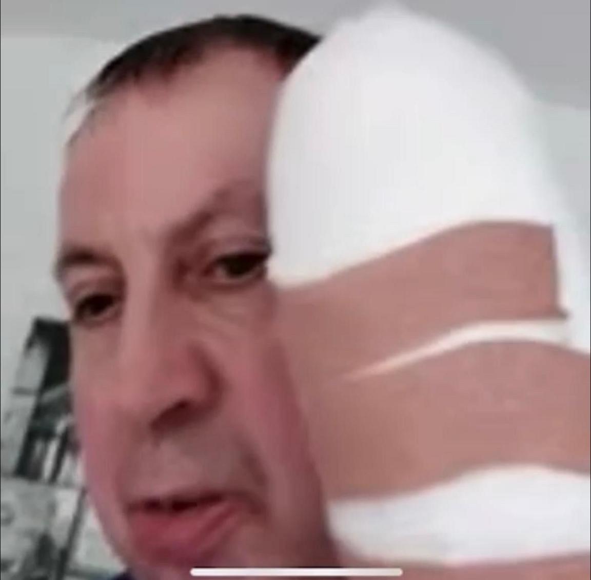 A photograph of Stephen Crean with his hand in bandages 