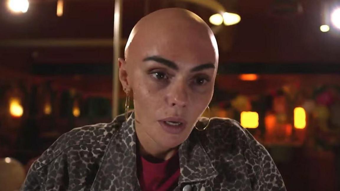 Hollyoaks character Mercedes McQueen played by actress Jennifer Metcalfe is seen without any hair