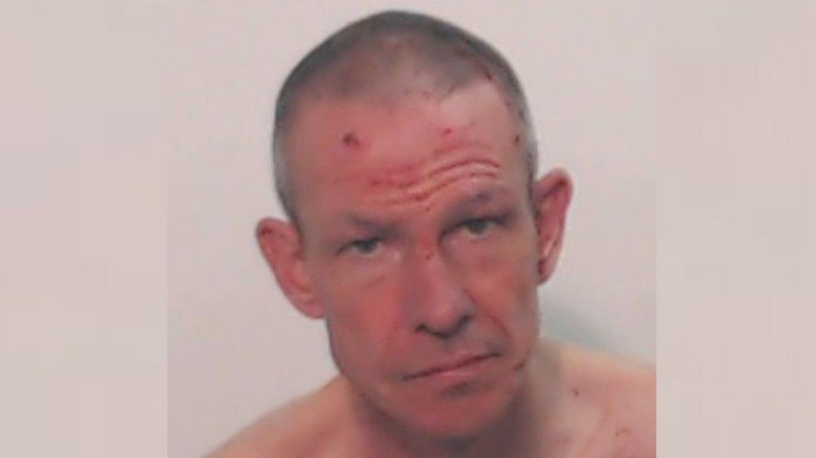 A police mugshot of a shaven-headed man whose face has several cuts on it