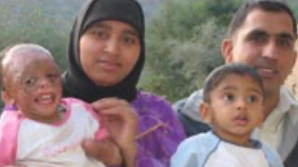 The family in Pakistan after Shamiam was badly burnt. She is pictured as a young child being held my her mother with her father Mohammad and brother Shakaib next to them.