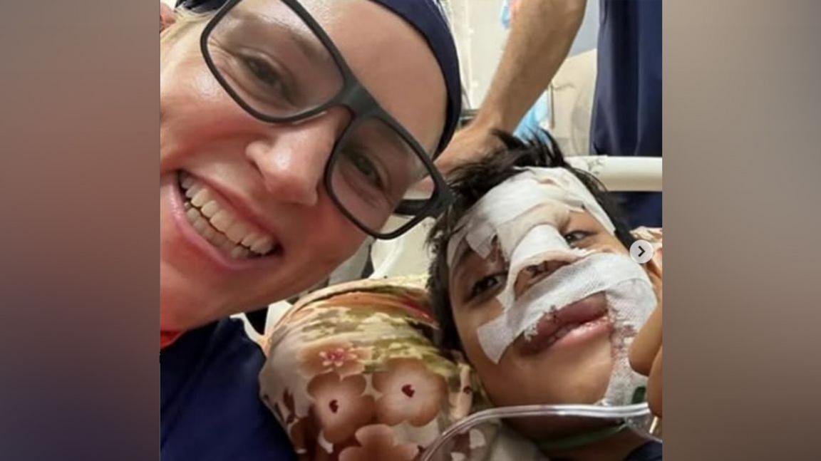 Victoria smiles next to her patient who is also smiling. He is a young boy with is face covered in bandages. Facial injuries can be seen beneath. 