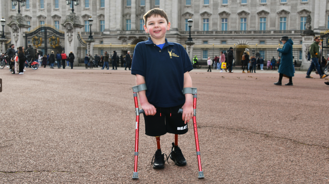 Tony Hudgell standing on prosthetics and crutches outside Buckingham Palace