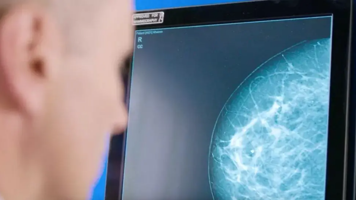 A close-up of someone looking at a digital scan of a breast.