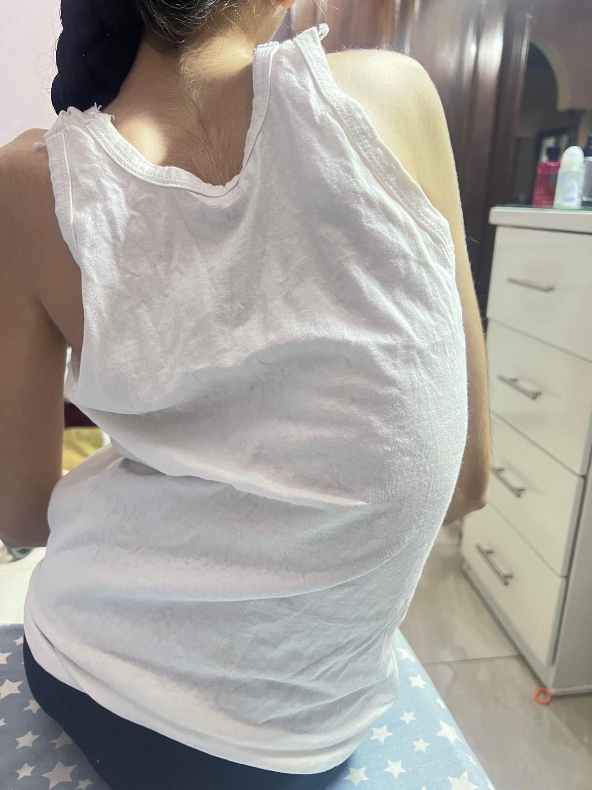 Lamis's torso pictured from behind inside a room. She is wearing a white tank top and her back is twisted with severe scoliosis