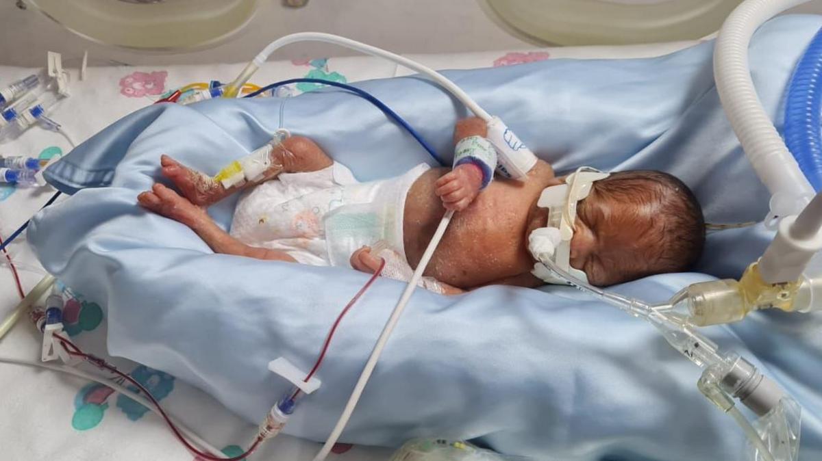 Premature baby lying in incubator on hospital ward