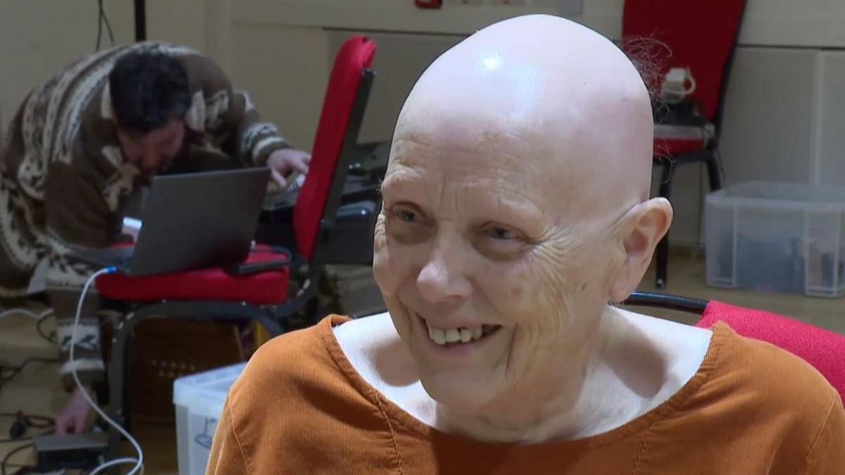 Mae dawnsio creadigol yn helpu Buddug Jones, 80, i gadw'n heini ar ôl derbyn ysgwydd a phen-glin newydd dros y blynyddoedd diwethaf