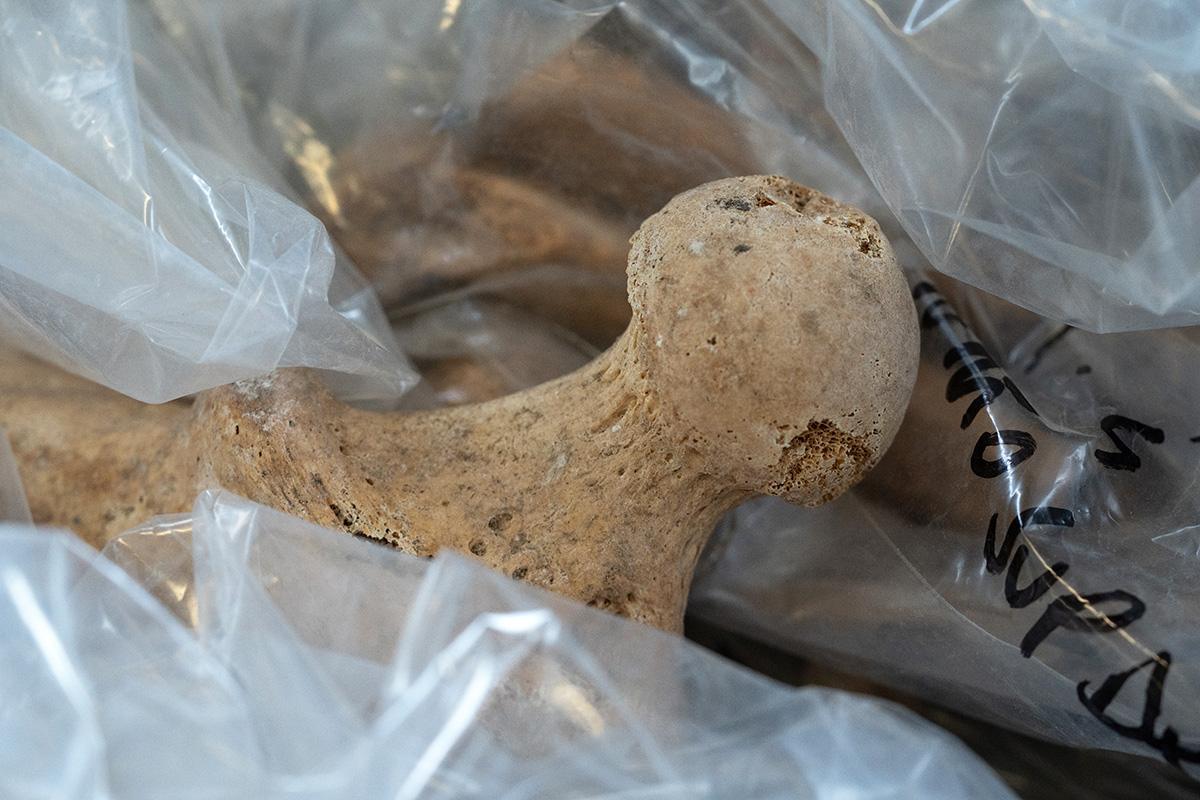 A human leg bone in a plastic bag