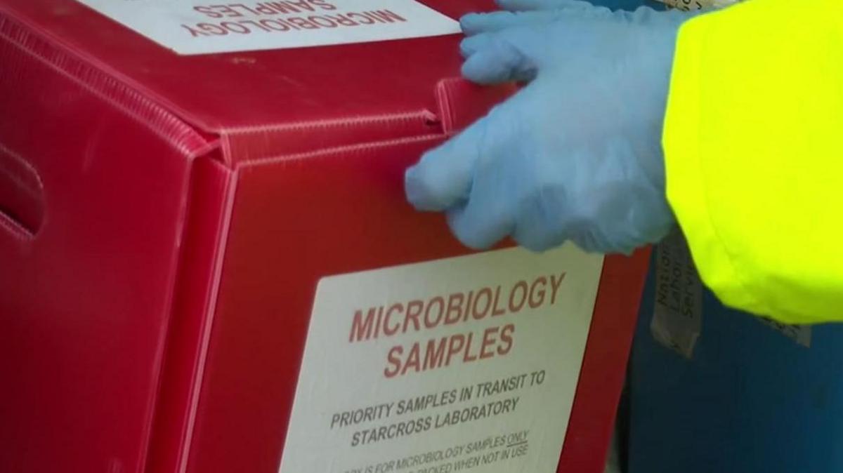 Microbiology samples