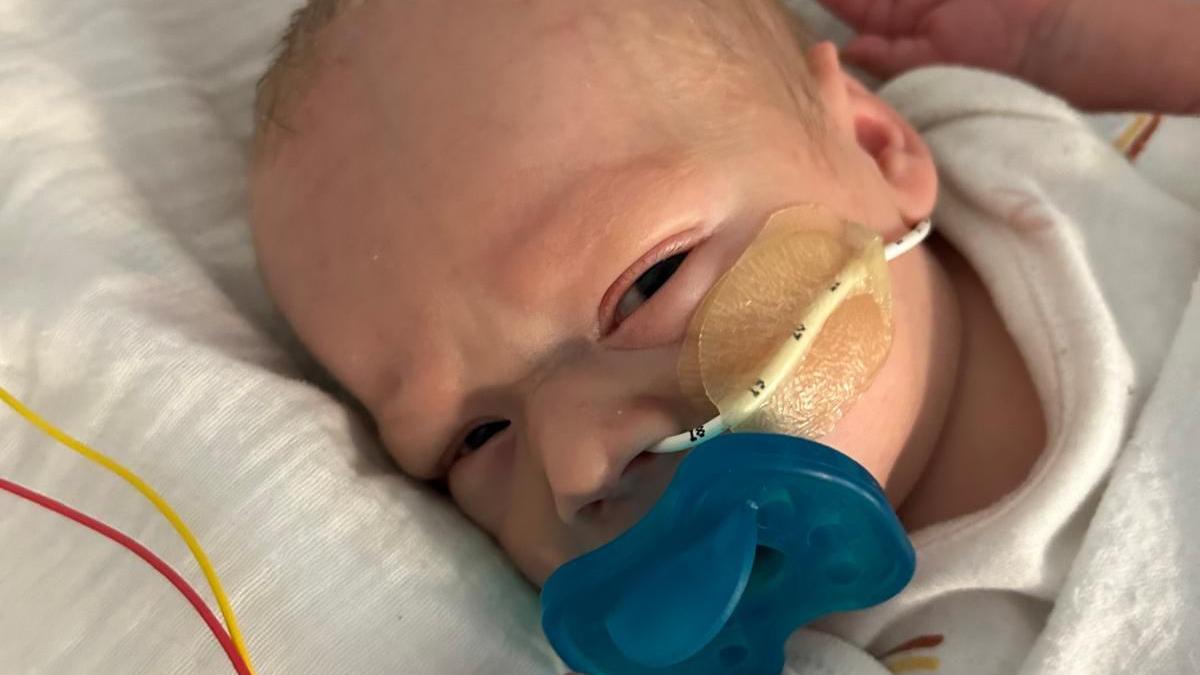 Baby Milo with a white feeding tube and blue dummy, lying on a hospital bed