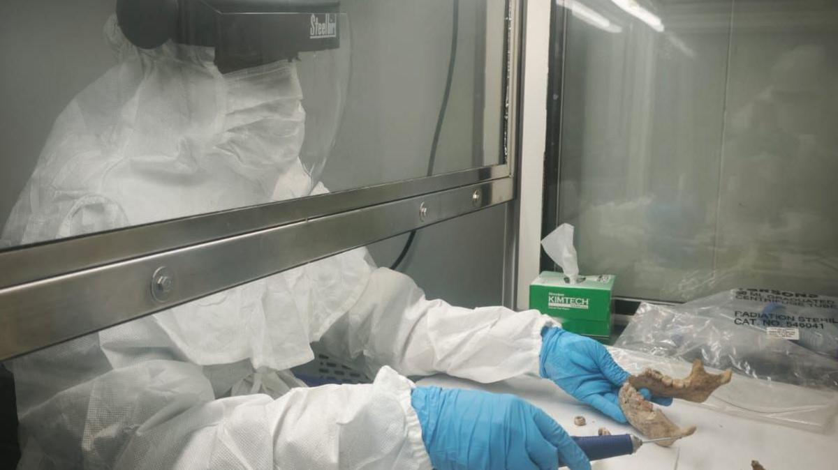A researcher uses a drill to extract bone fragments from a human skull at Madurai Kamaraj University in Tamil Nadu, India.
