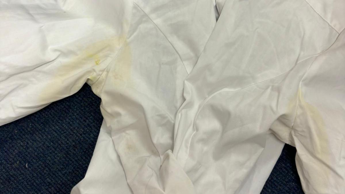 A white collared shirt with large yellow sweat stains in the armpit areas.