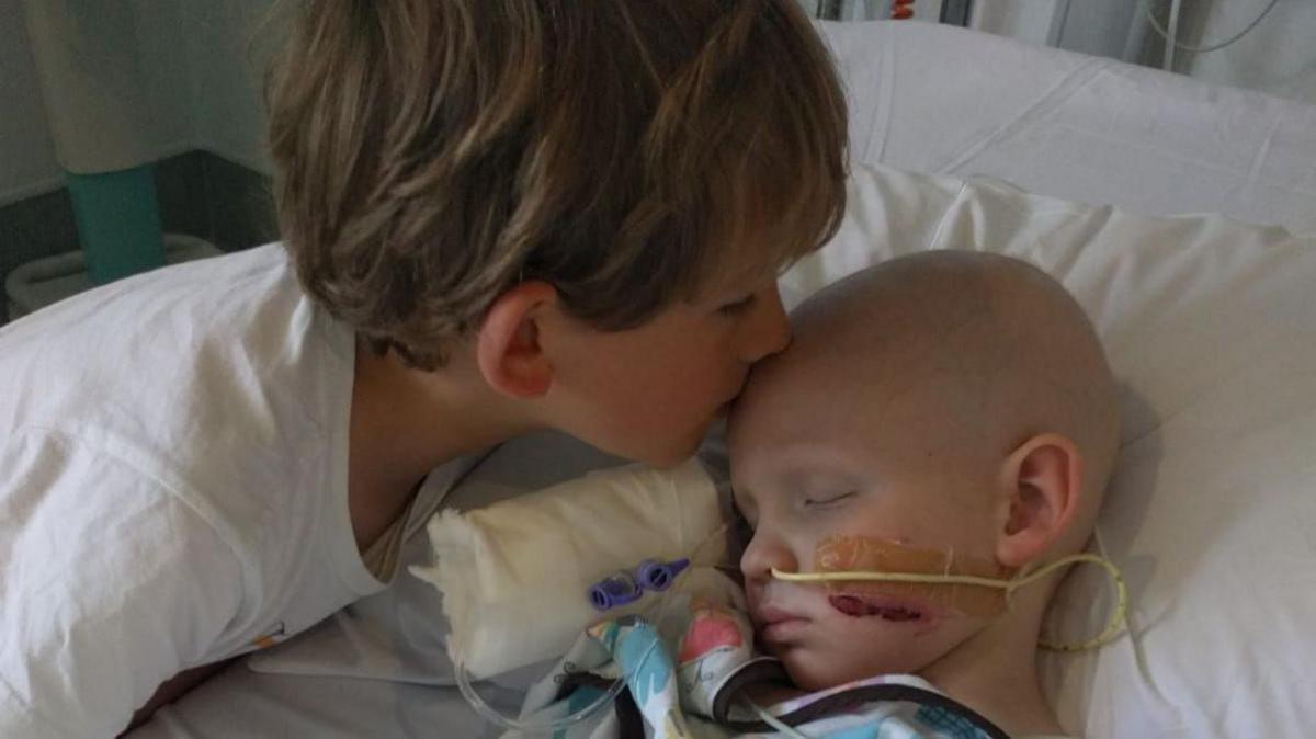 George asleep with a tube through his nose and being kissed by his brother Alex