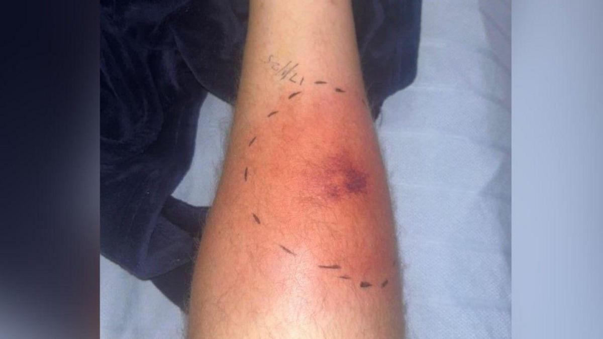 A red patch on his leg. Above it on the image is a date written on the leg.