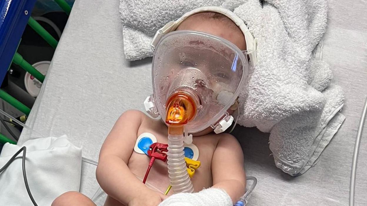 Baby Isla in hospital wearing a mask to help her breathe and she is surrounded by tubes 