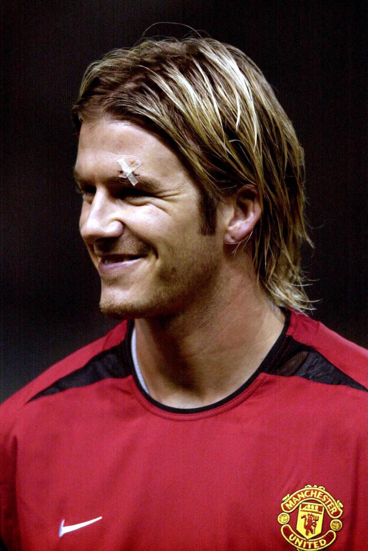 David Beckham with stitches on his left eyebrow